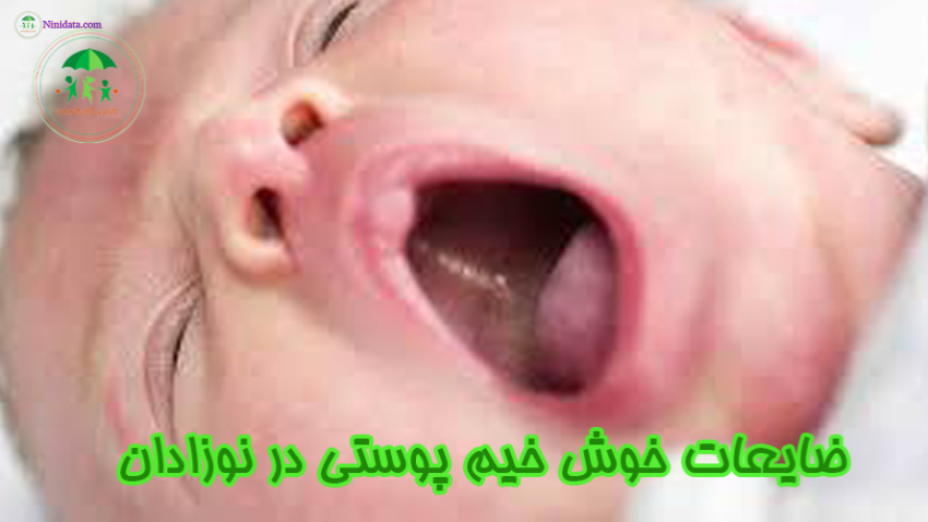 ninidata.com | پوست نوزادان