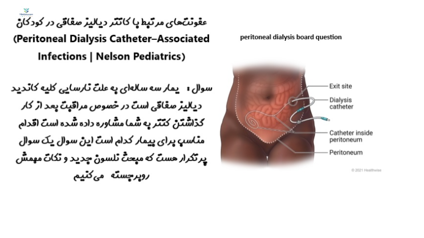 ninidata.com | عفونت‌های مرتبط با کاتتر دیالیز صفاقی در کودکان