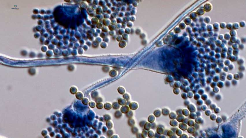 ninidata.com | اسپرژیلوس ریوی در  بورد اطفال